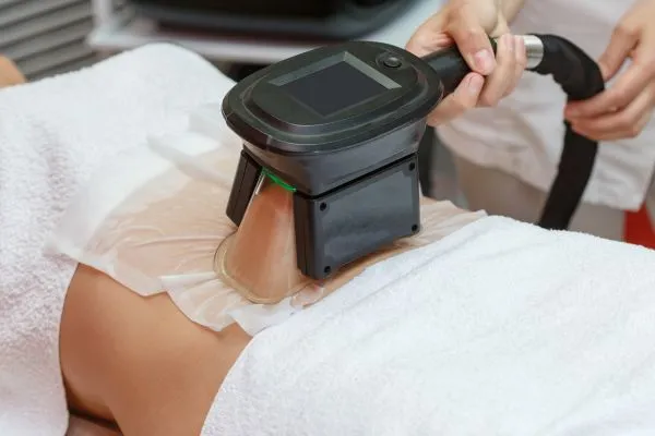 Image of person having fat freezing treatment to help weight gain Shefford