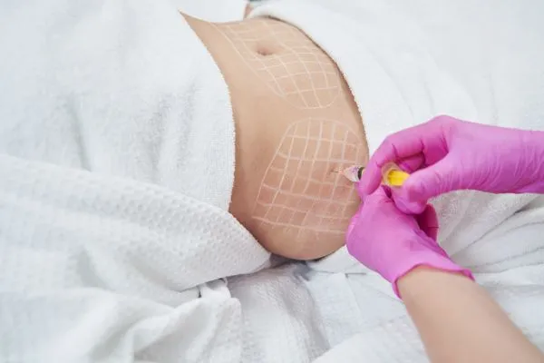 image of fat dissolving injections on love handles to help combat weight gain Shefford