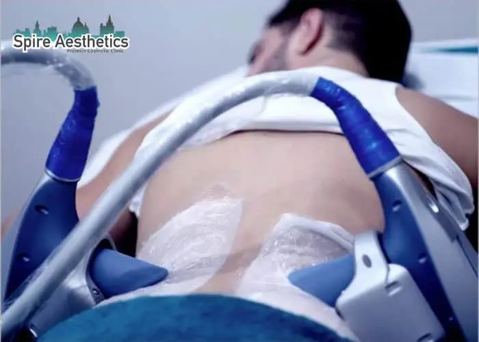 Man having fat freezing treatment done on love handles before a competitions Shefford to create a sculpted look.