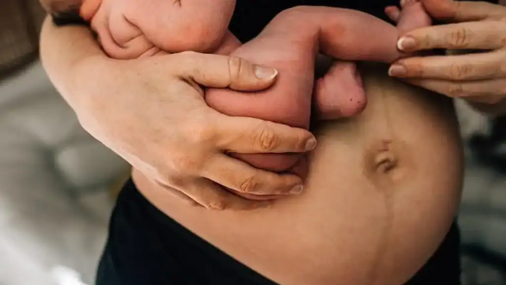 Why Is My Stomach Still Big After Pregnancy Shefford?